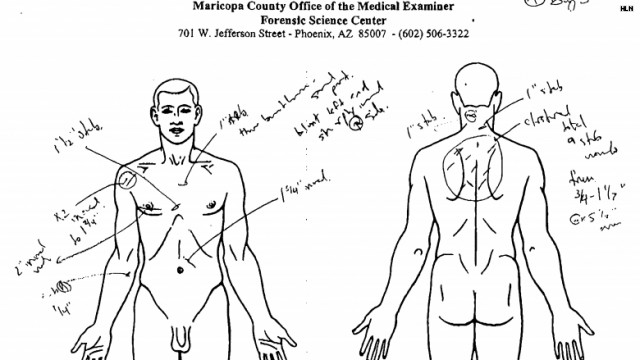 Jodi Arias Autopsy Photos Murderpedia The Encyclopedia Of Murderers   Travis Alexander Autopsy 1 